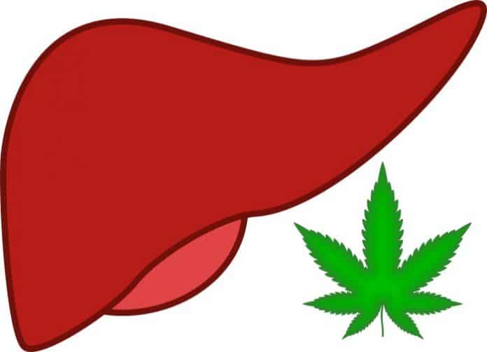 Cannabis and NAFLD