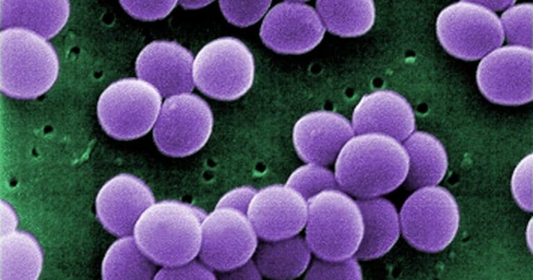 Staphylococcus aureus and cannabidiol