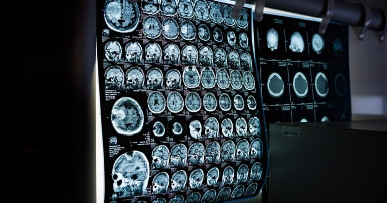 Cannabis and brain safety