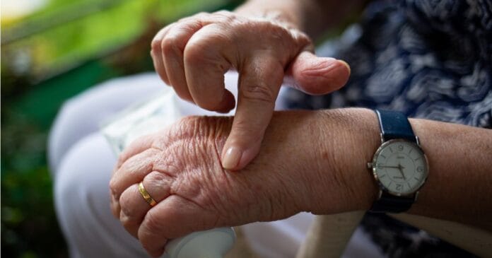 Cannabinoids and arthritis