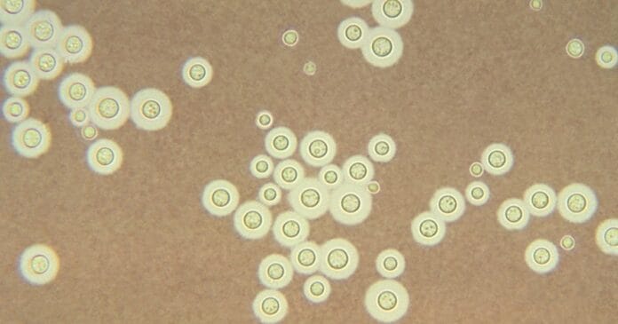 anti-fungal-cannabinoids Cryptococcus neoformans