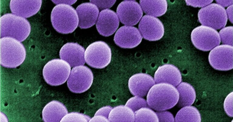 Staphylococcus aureus