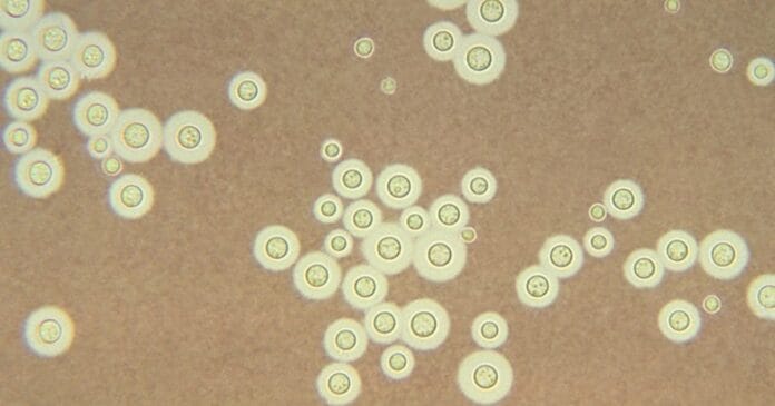 Cryptococcus neoformans